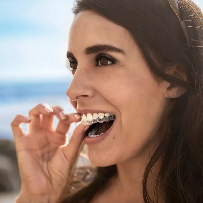 Do I need Invisalign? Image (Mobile)