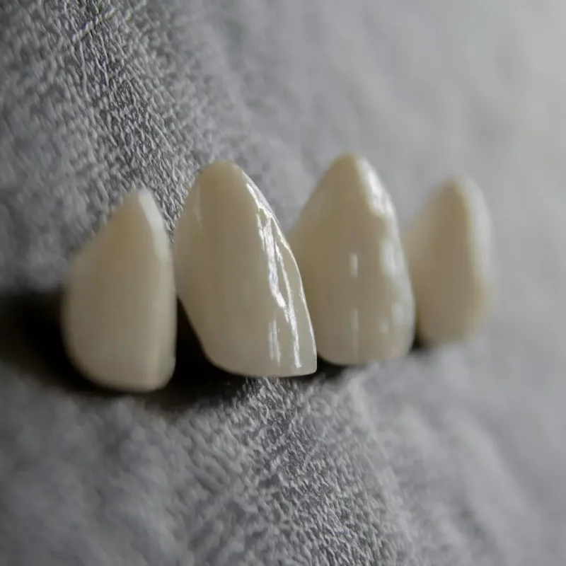 What are Porcelain Veneers?