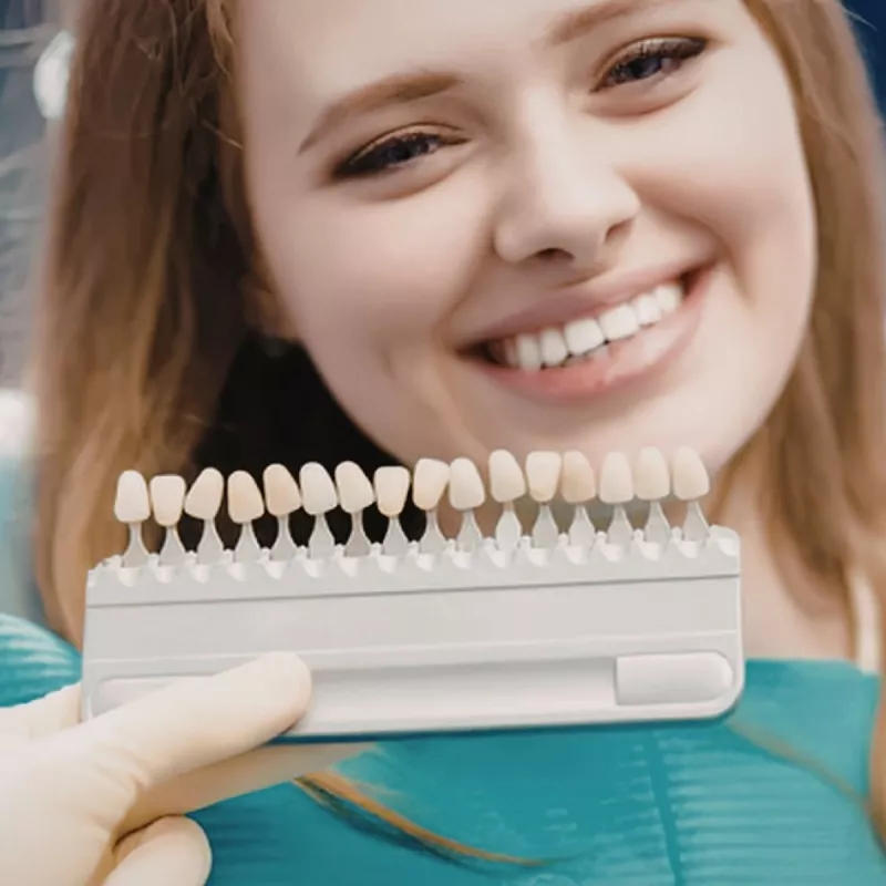 Teeth Whitening Kingston in Norbiton, Kingston-upon-Thames Image (Mobile)